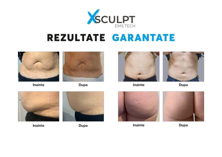 XSculpt