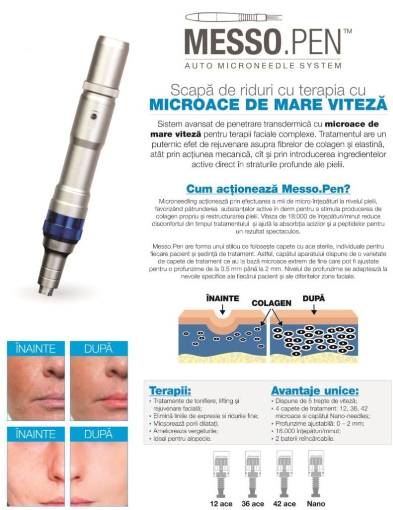 MessoPen Botoșani - Vogue Beauty Center